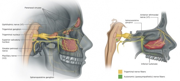 sinus migraine illustration