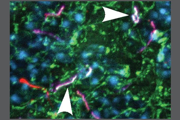 The arrows show neuronal primary cilia in a mouse cerebral section transduced with adenoviruses coding for somatostatin receptor 3 (SSTR3)-BirA2
