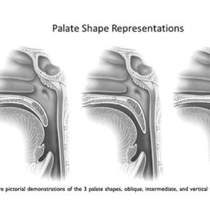 Palate Shape Representations